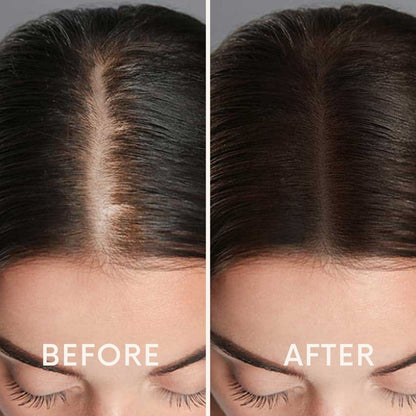 Seurico™ |  Laser Cap for Hair Growth ❤️TIKTOK