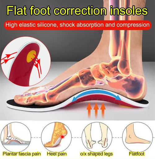 The Secret Weapon for Pain-Free Walking!-Seurico™ Flat Foot Correction Insoles